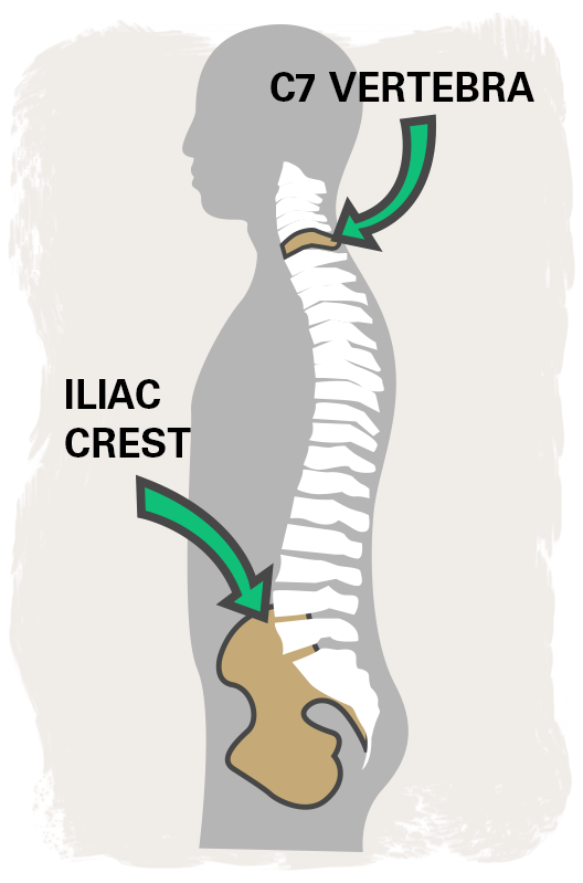הדמיה - איך התיק בנוי בהתאם לצורת עמוד השדרה